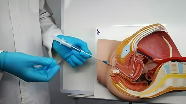 tratamientos Ginecología Oncológica en merida